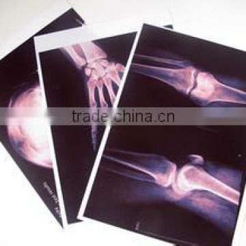 Konida laser x-ray film dryer scrap,printed with fuji thermal printers