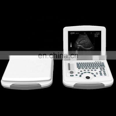 High Quality Medical ultrasound instruments Portable 10.4 inch Laptop Black and White Scanning Ultrasound