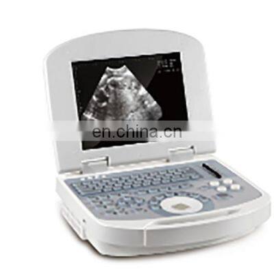 Full Digital Black and White Laptop Doppler Diagnostic System Ultrasound photo-5