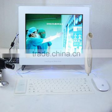 (AYJ-J009D) AY Plus factory OEM portable mammography equipment