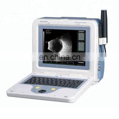 Portable A B Eye Test Ophthalmic Ultrasound Scanner with touch screen