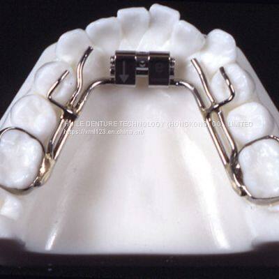 Orthodontic-Appliance  China Dental Laboratory - Outsourcing Dental Lab