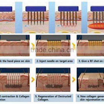 Fast Cooling System! RF Fractional Micro Needle Machine With 0.25mm - 3mm Adjustable Needle