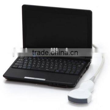 Portable Laptop Ultrasound Scanner With CE photo-3