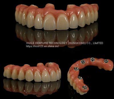 Clear Aligner Lab From China Orthodontics Lab From China photo-3
