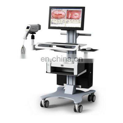 High Definition Digital Video  Gynecological Colposcope Multi-functional Trolley Colposcope