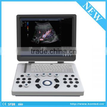 KONTED C6 USG Full Digital 4D Laptop Ultrasound Machine Price Portable 4D Ultrasound Machine