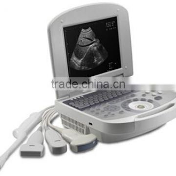 Medical Laptop B mode Ultrasound Scanner RUS-2200 USB 2.0 optional Biopsy Brackets