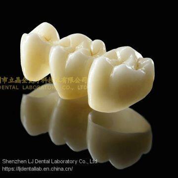 Dental Crown 3M Lava Zirconia, Dental Teeth, Dental Prosthesis, Laboratoire Dentaire, Dentallabor, Laboratorio Dental, Dental Laboratory, Shenzhen LJ Dental Lab China photo-5