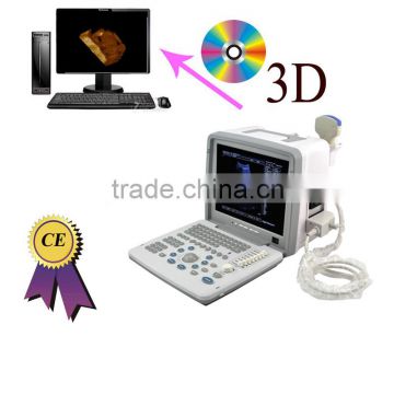 Factory price!CE approved Notebook B-Mode Ultrasound Scanner with 7.5Mhz multi-frequency linear probe RUS-9000B