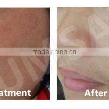 2016 New Product Led Freckle Removal      Pdt Machine Ce Medical Multi-Function photo-6