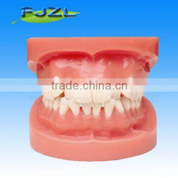 orthodontic teeth model/dental orthodontic models