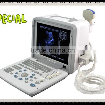 CE Approved 12 inch LCD monitor Portable Ultrasound Scanner with Convex Linear micro-convex probe manufacturer