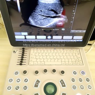 Ultraslim Notebook Type Black and White Ultrasound Scanner Devices