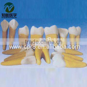 Tooth model(ampication) BIX - L1034