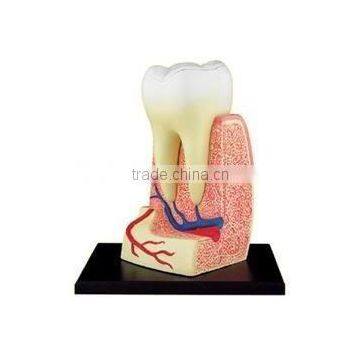 Tooth