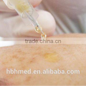 Non-pyrogenic Platelet Rich Plasma Prp Kit Easy photo-3