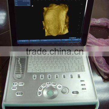 Sonostar Hospital Veterinary Equipment B Model Ultrasound Machine for Sale V9 photo-4