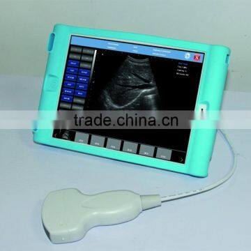 High quality USB port Ultrasound scanner