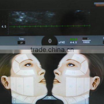 High Intensity Focus Ultrasound HIFU for Face and Neck Lift Without Surgery photo-2