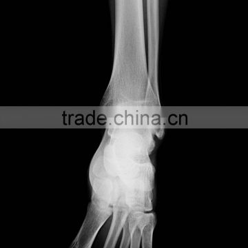 China consumable medical supplies medical radiography film KND-A/F CE