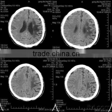 Women hot sex images, x-ray medical thermal dry films of computed radiography