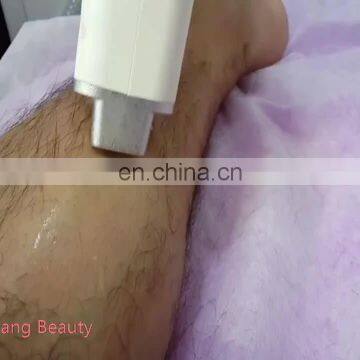 portable  808nm  diode laser permanent hair removal beauty machine design by chip