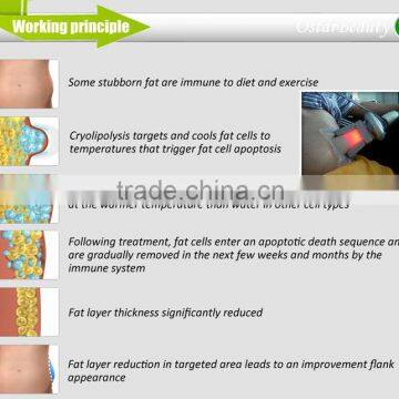 Hot Sale Freezing Fat Slimming Machine Medical photo-5