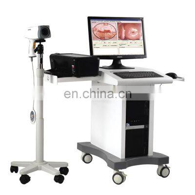 Hot sale High quality Digital Optical Video Vagina Colposcope with camera,printer andcart For Gynecology