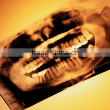 china wholesale dental x-ray film scanner, industrial x-ray film viewer, x-ray film developer and fixer