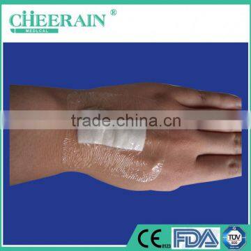 Breathable Medical Semi-Permeable Adhesive Island Dressing