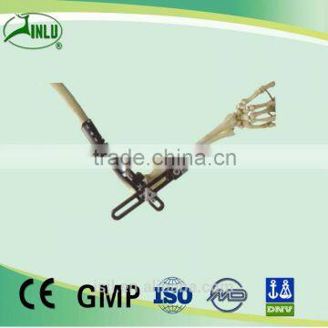 Elbow joint frame Bone Fracture External Fixation