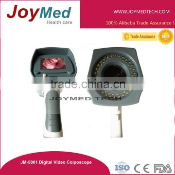 remote control digital video colposcope