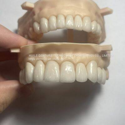 Flexible Partial Denture Zirconia Dental Crown