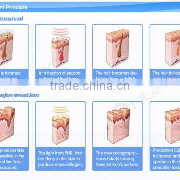 FDA Approved Germany Oxenon Lamp IPL Elight Hair Removal Ipl Laser Machine photo-5