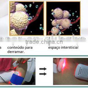 SUS Portable Lipo Diode Laser Slimming Diode Laser Medical Laser Sliming photo-2