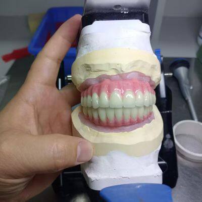 Implant Zirconia Crown and Bridge - China Dental Lab of Good Quality and Professional Technicians