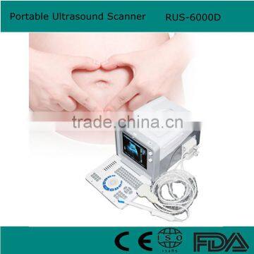 10 inch Ultrasound Scanner Portable Ultrasonic Diagnostic Machine with 3.5MHz Convex Probe good price