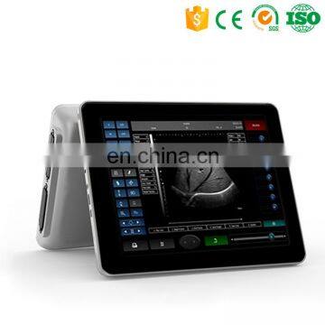 MY-A011 2015 high quality medical touch screen B ultrasound scanner / hospital portable ultrasonic diagnostic device