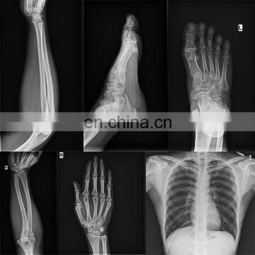 MY-D019A High Frequency Medical X-ray Generator or Fluoroscopy Machine of Digital Portable x Ray for Sale photo-7