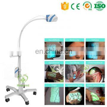 MY-G060E Medical Equipment Vein Viewer System Vein Sight Portable Vein Finder photo-3