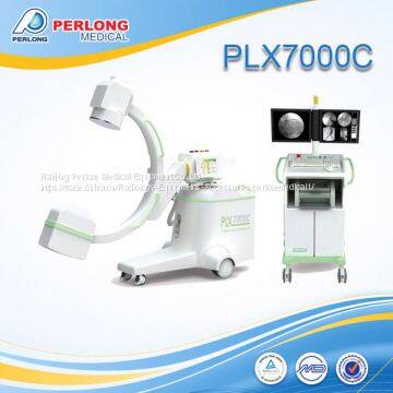 Digital C-arm system PLX7000C for ERCP diagnosis