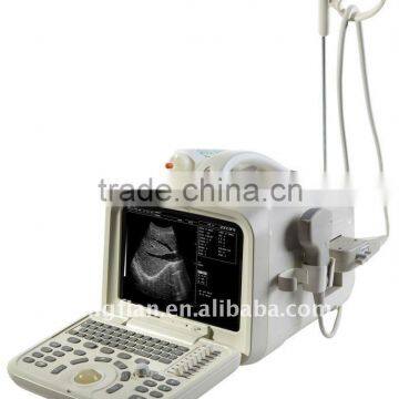 ultrasound body scanner