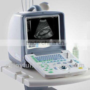China Best B Ultrasound Scanner for Sale