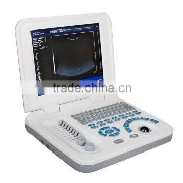 Hot Cheapest Large Screen 10.4 Inch Laptop Ultrasound Scanner Machine With Probe--RUS-9000F2 photo-2