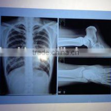 2015 new film from china laser film x-ray machine medical x ray film,medical equipments not phone