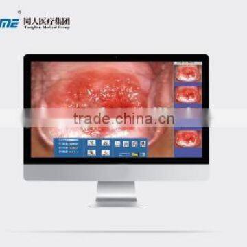 Digital Video Colposcope, Laptop Video Colposcope, Gynecology Video Colposcope photo-3