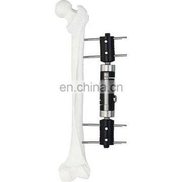 Excellent Quality Orthopedic Surgical Instruments Straight Type External Fixator Orthopedic Medical Implant External Fixation photo-2