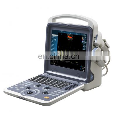 HC-A012E Portable color doppler ultrasound system ultrasound instruments