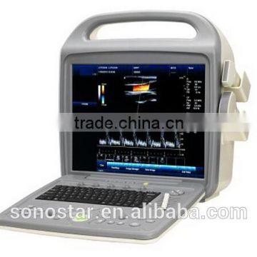 SS-1000 Color Doppler System